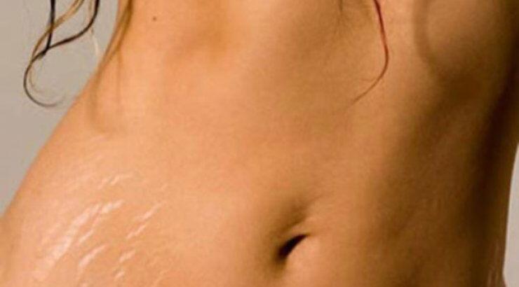  Ραγάδες: Γιατί εμφανίζονται και πώς αντιμετωπίζονται 