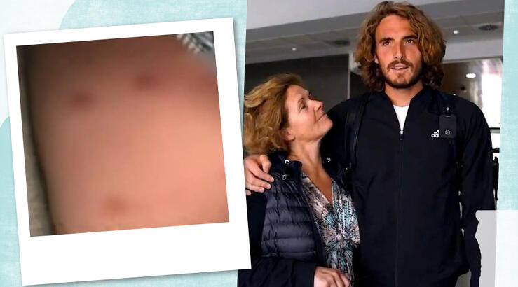 Στέφανος Τσιτσιπάς: O σκύλος της οικογένειας του επιτέθηκε σε περαστικό και τον έστειλε νοσοκομείο [βίντεο]