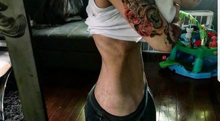 Σοκάρει η σκελετωμένη εικόνα επώνυμης Ελληνίδας