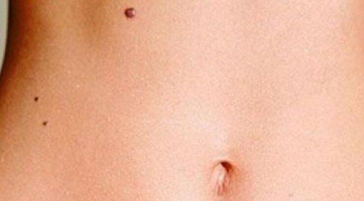 Ύποπτες ελιές: Τα 4 σημάδια που πρέπει να προσέξετε 