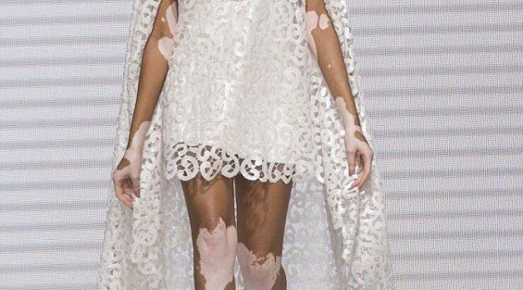 Διαφορετική ομορφιά: Η Winnie Harlow έκλεψε τις εντυπώσεις στην εβδομάδα μόδας στο Παρίσι