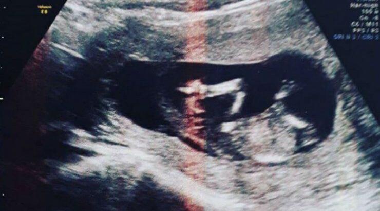 Χαρμόσυνα νέα για γνωστή Ελληνίδα – Περιμένει το πρώτο της μωράκι!