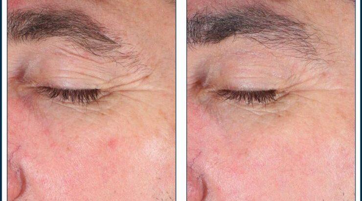 Το νέο προϊόν της Skinbetter Science, EyeMax AlphaRet Overnight Cream υπόσχεται να σας καταπλήξει! 