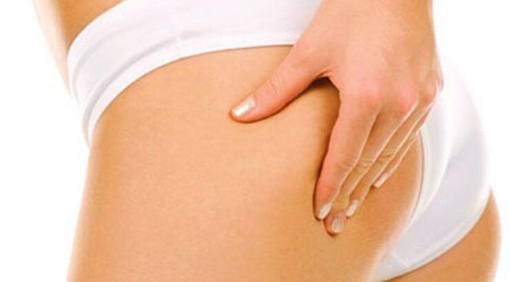 Κυτταρίτιδα και τρόποι αντιμετώπισης