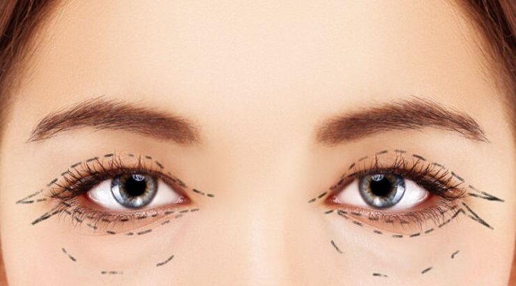Όμορφα μάτια και βλεφαροπλαστική