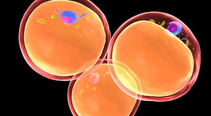 Λιπομεταφορά: H δημοφιλής λύση