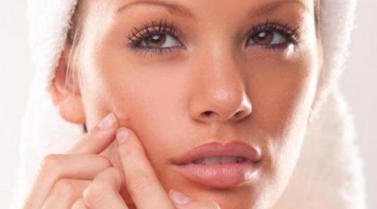 Όλα όσα πρέπει να γνωρίζετε για το σπυράκι 