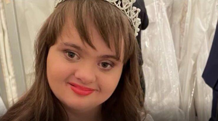 Η 18χρονη Βαλάντω είναι η πρώτη στην Κύπρο με σύνδρομο down που μπήκε στον χώρο του μόντελινγκ [βίντεο]