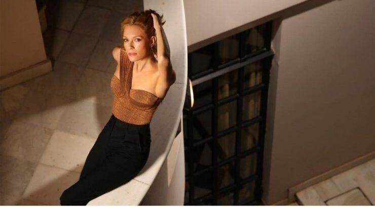 Bίκυ Καγιά: Η αποκάλυψη που έκανε για το δερματικό πρόβλημα που αντιμετώπισε