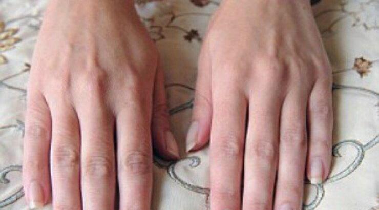 Στα άκρα: Αυτό είναι το μοντέλο που κερδίζει χρήματα ως μοντέλο χεριών