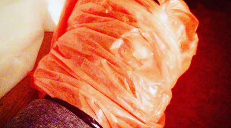 Το ατύχημα Ελληνίδας τραγουδίστριας επί σκηνής!