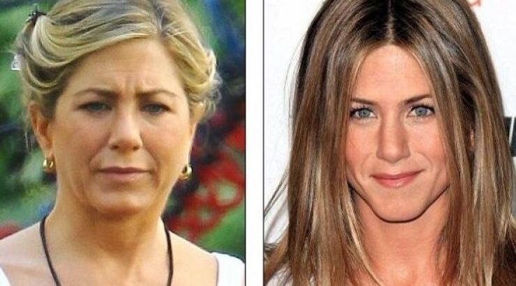 Απίστευτο! Πρήστηκε το πρόσωπο της Άνιστον!