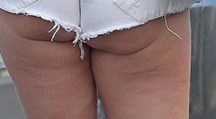 Η κυτταρίτιδα και η χαλάρωση σε εμφάνιση επώνυμης τραγουδίστριας