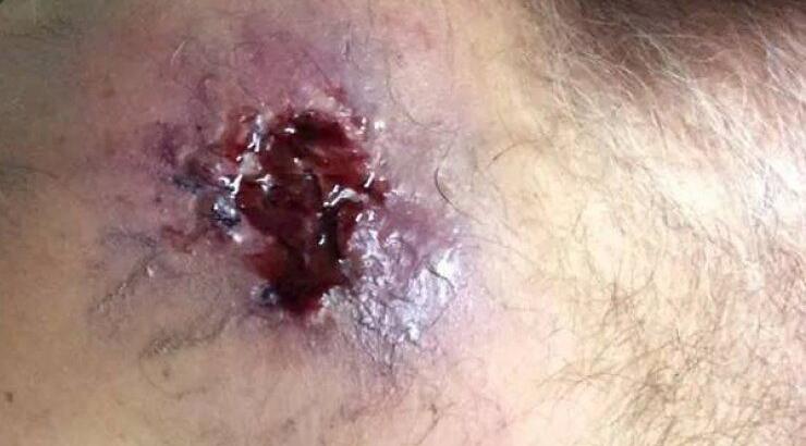 Το σοβαρό τραύμα ηθοποιού που συμμετέχει σε κυπριακή σειρά