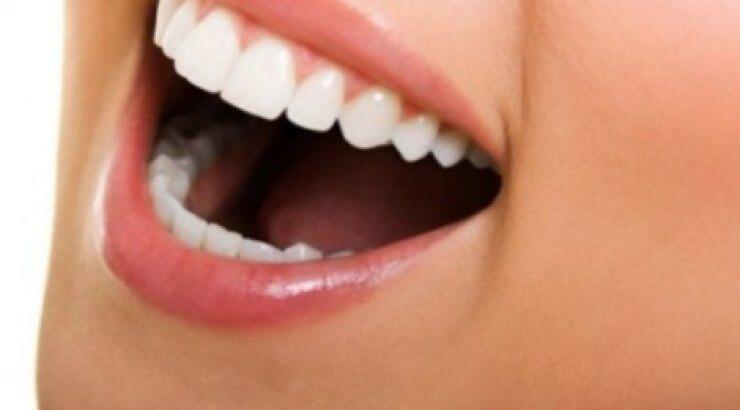 Ποιες τροφές προκαλούν λεκέδες στα δόντια; 