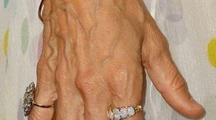 Σε ποια πασίγνωστη ηθοποιό ανήκουν αυτά τα γερασμένα χέρια;