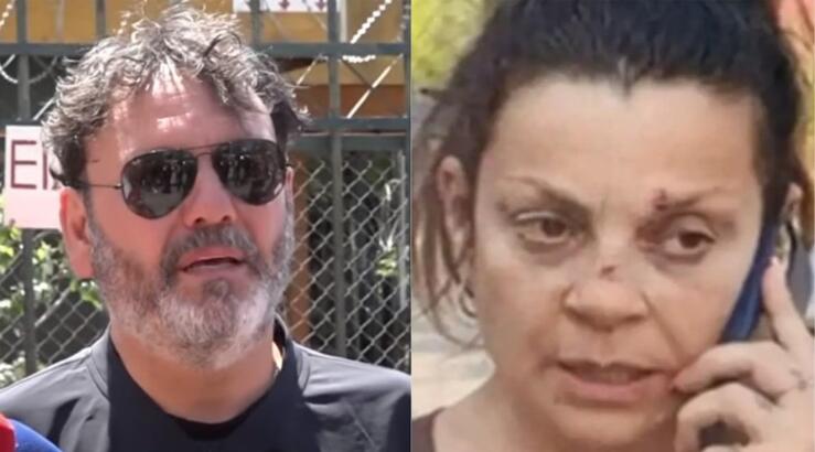 Πρώην σύζυγος Στάθη Αγγελόπουλου: «Moυ πέταξε τα κλειδιά στο πρόσωπο. Με έσπρωξε κατά λάθος;»