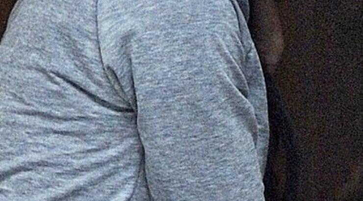 Δείτε μία από τις ωραιότερες γυναίκες του πλανήτη άβαφτη με σπυριά και μαύρους κύκλους