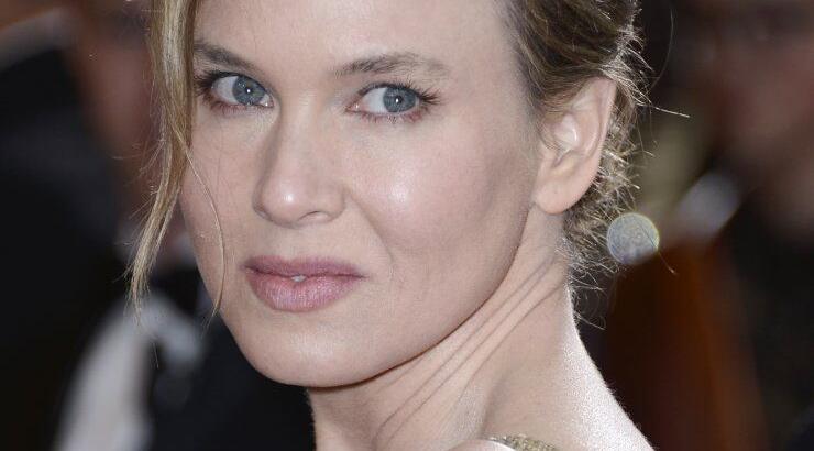 To παράκανε η Renee με το μπότοξ;