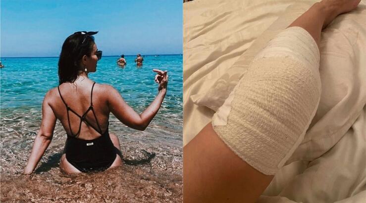 H Kύπρια ηθοποιός τραυματίστηκε στην πρεμιέρα της επί σκηνής και μεταφέρθηκε στο νοσοκομείο