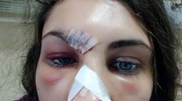 Σοκάρει επώνυμη Ελληνίδα με φωτογραφίες που τη δείχνουν χτυπημένη στο νοσοκομείο