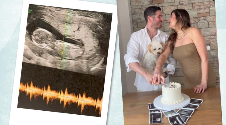 Baby boom στη showbiz: Μόλις μάθαμε τα ευχάριστα για διάσημη Ελληνίδα  