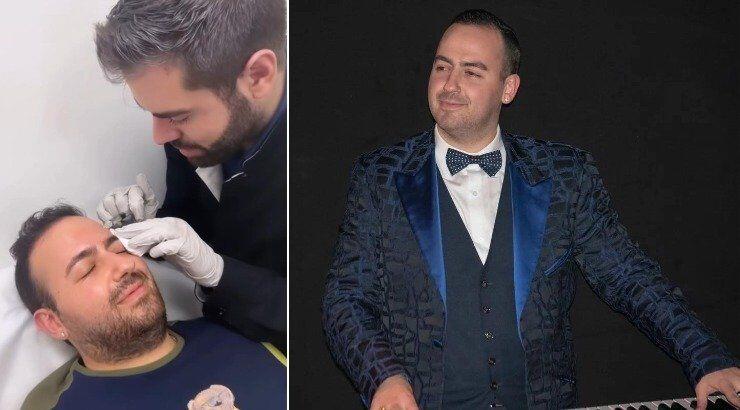 Μαυρίκιος Μαυρικίου: Κάνει θεραπεία προσώπου με σπέρμα σολωμού και γίνεται viral [βίντεο]