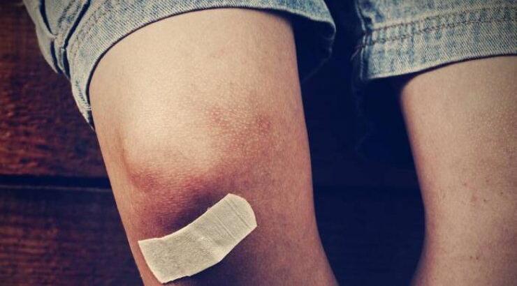  Πώς εξαφανίζουμε τις μελανιές 