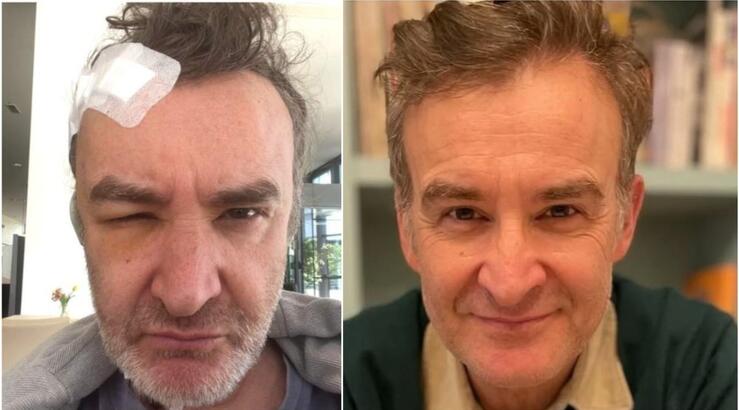 Νίκος Ορφανός: «Ήρθα εδώ γιατί είχα έναν όγκο στο κεφάλι. Είχα κρανιοφαρυγγίωμα»