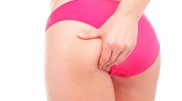 Χρήσιμες συμβουλές για να πεις αντίο στην κυτταρίτιδα μια για πάντα  