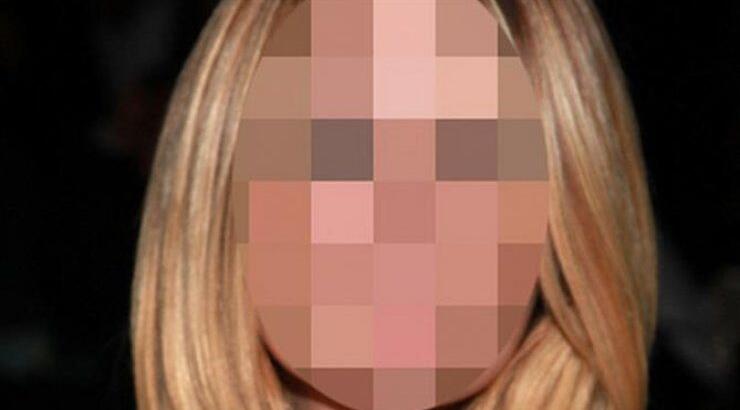 Ηθοποιός μετάνιωσε που έκανε ενέσεις botox