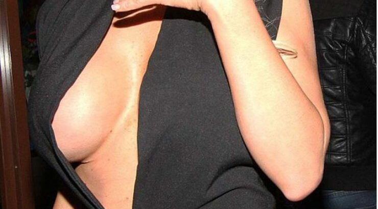 Το βαθύ σκίσιμο αποκάλυψε την πλαστική στο στήθος. Και δεν έχει κάνει μόνο μία...