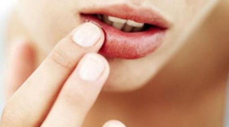 Γιατί το χειμώνα σκάνε τα χείλη;