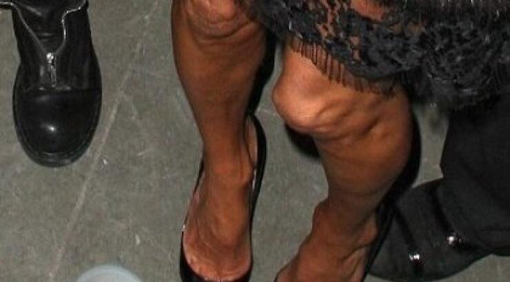 Σε ποιο κορυφαίο μοντέλο ανήκουν αυτά τα πόδια;