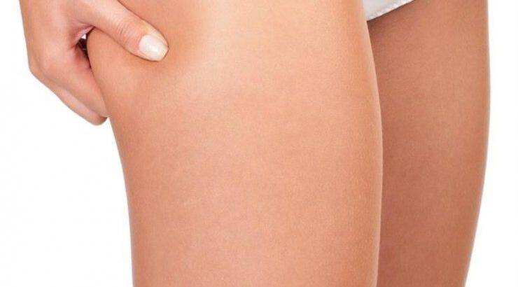 6 τροφές κατά της κυτταρίτιδας