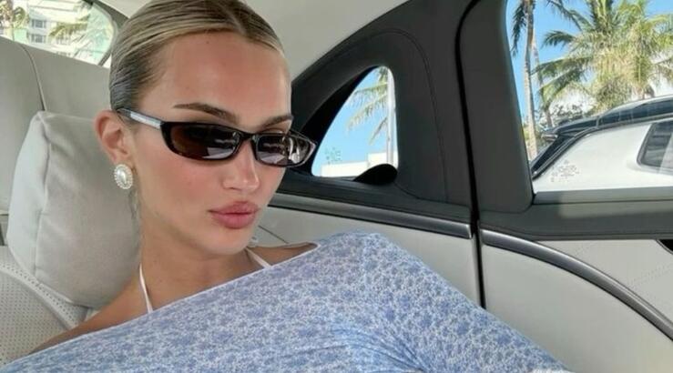 Σημάδια Ακμής: Η σωστή αντιμετώπιση σύμφωνα με δερματολόγο