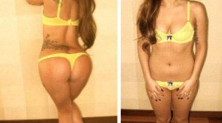 Η Gaga στη μάχη κατά της ανορεξίας!