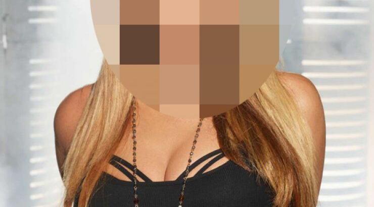 Πασίγνωστη τραγουδίστρια εξομολογείται: "Είχα τρέλα με το botox"