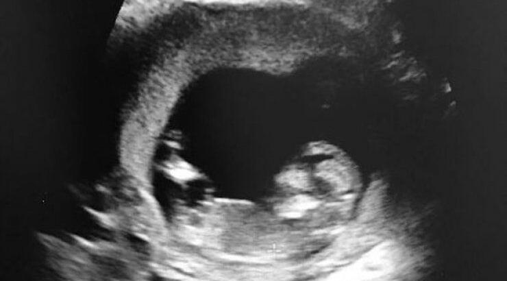 Γνωστό ζευγάρι ανακοίνωσε τον ερχομό του πρώτου του παιδιού την Ημέρα της Μητέρας