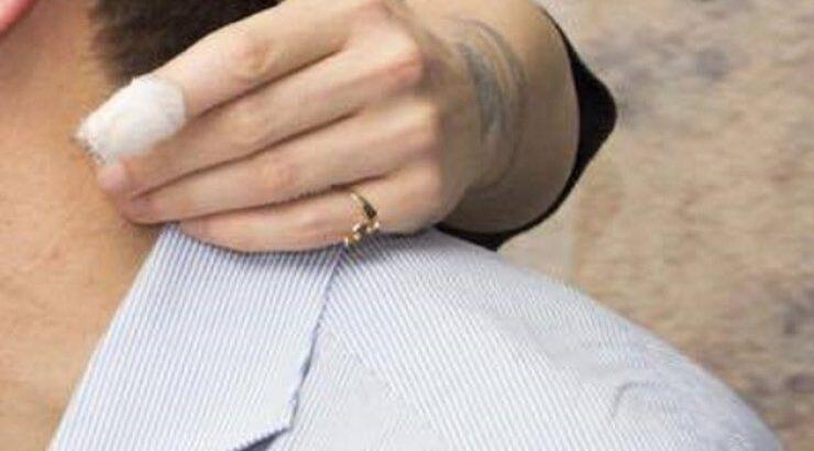 Απίστευτο: Το σοβαρό ατύχημα Ελληνίδας ηθοποιού. Έχασε μέρος του δαχτύλου της