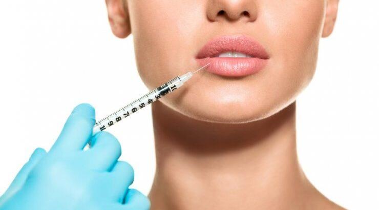 Lip Injection: Όλα όσα πρέπει να γνωρίζεις για την αυξητική των χειλιών