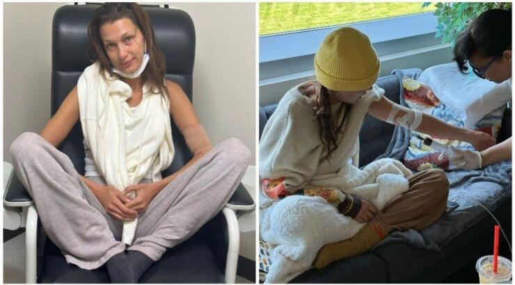 Bella Hadid: Η μάχη με τη νόσο Lyme – Οι εικόνες που δημοσίευσε κατά τη διάρκεια της θεραπείας 