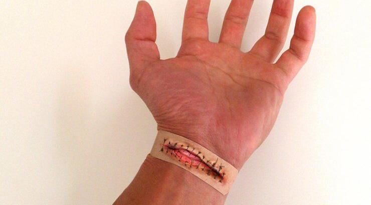 Τσιρότα Boo boos