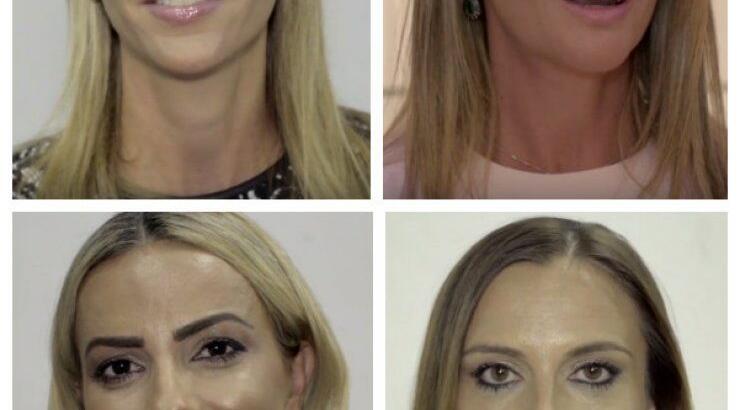 Το μήνυμα που στέλνουν 12 Κύπριες για τον καρκίνο του μαστού!