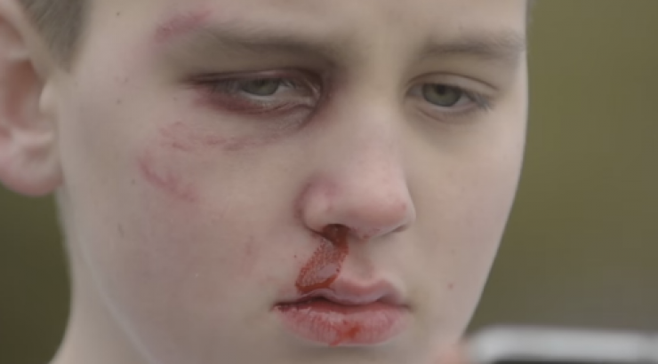 Το μικρού μήκους βίντεο για το cyber bullying που δημιούργησε ένας έφηβος!