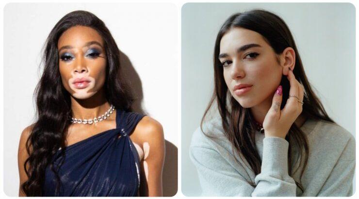 Κύπρια socialite ποζάρει με την Winnie Harlow και τη Dua Lipa! [εικόνες]