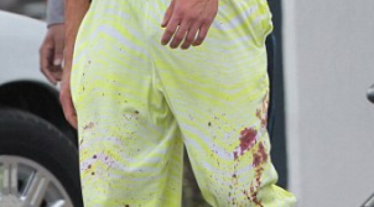 Πασίγνωστος ηθοποιός κυκλοφορεί στους δρόμους με ματωμένα ρούχα [εικόνες]