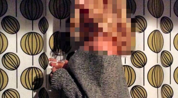 Επώνυμη Κύπρια μιλά για το πρόβλημά της με τη νευρική ανορεξία