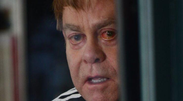 Elton John: Ταλαιπωρία με μόλυνση στο μάτι [εικόνες]