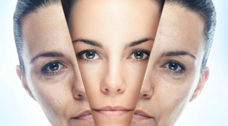 Αποκατάσταση ρυτίδων και όγκων με εμφυτεύματα υαλουρονικού οξέως